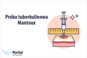 Próba tuberkulinowa Mantoux