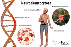 Neuroakantocytoza