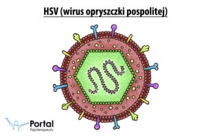 HSV (wirus opryszczki pospolitej)