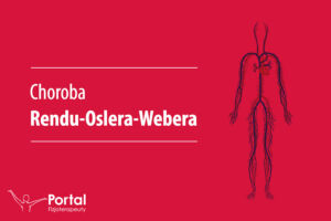 Choroba Rendu-Oslera-Webera
