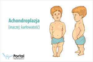 Achondroplazja (karłowatość)