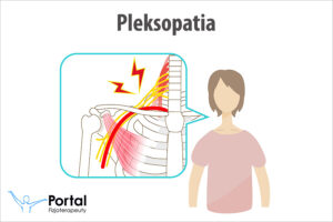 Pleksopatia