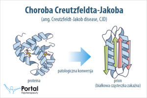 Choroba Creutzfeldta-Jakoba