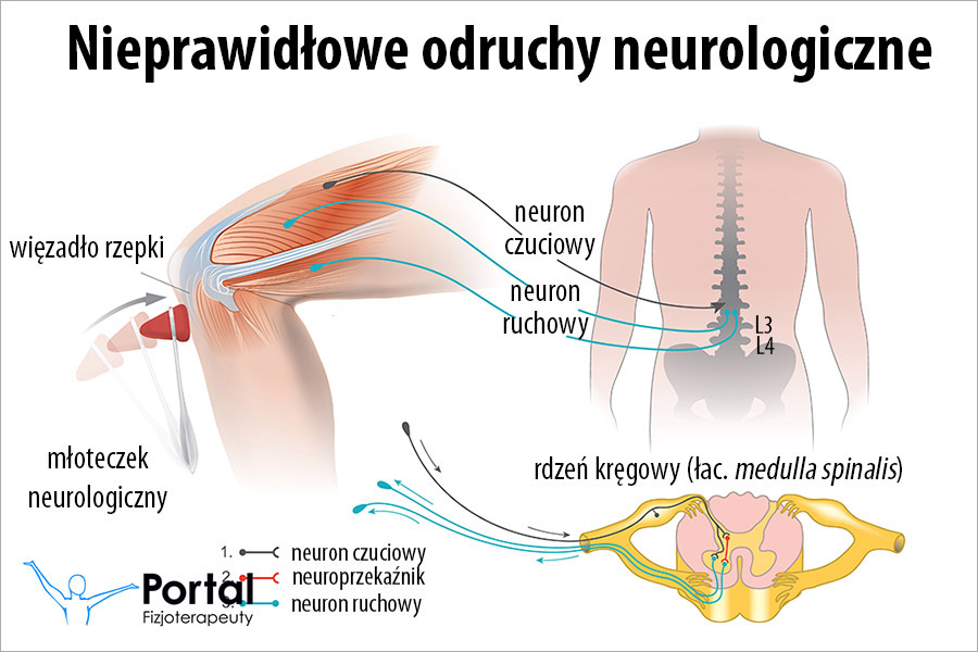 Nieprawidłowe odruchy neurologiczne