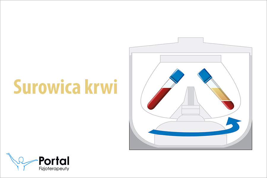 Surowica krwi