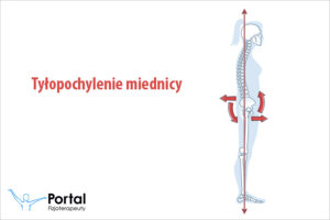 Tyłopochylenie miednicy