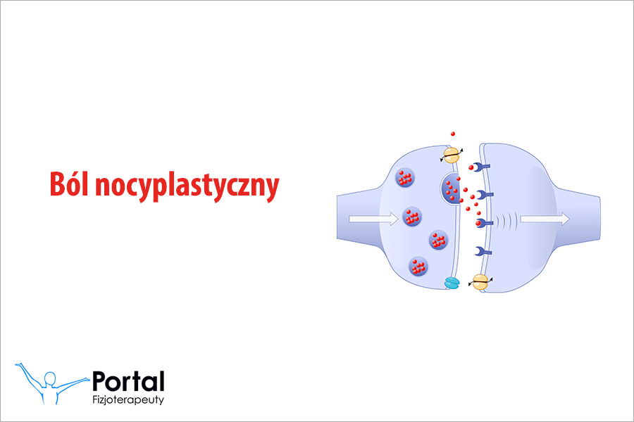 Ból nocyplastyczny