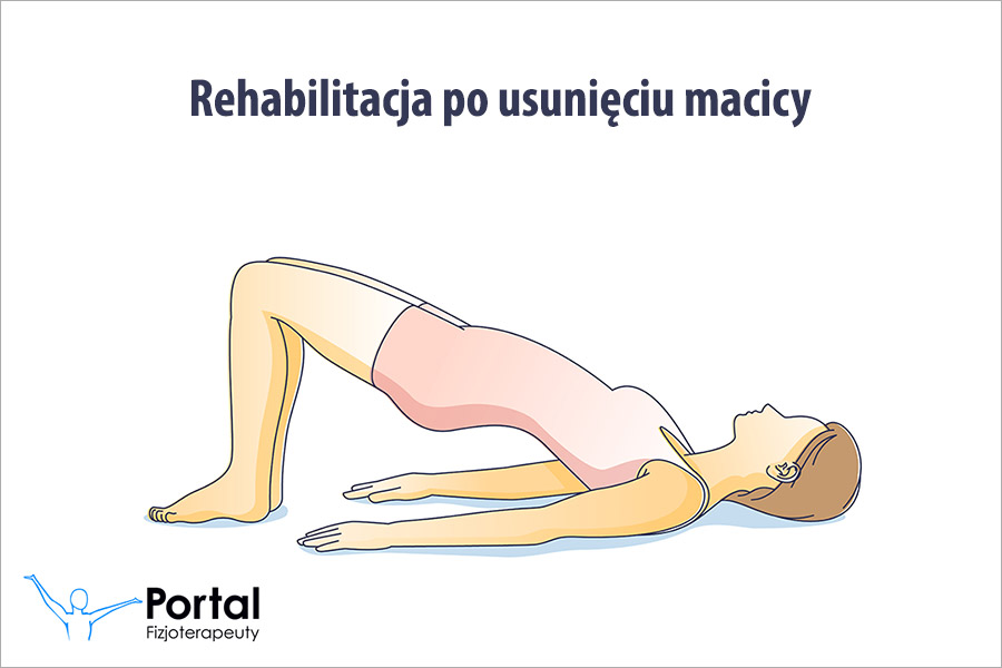 Rehabilitacja po usunięciu macicy