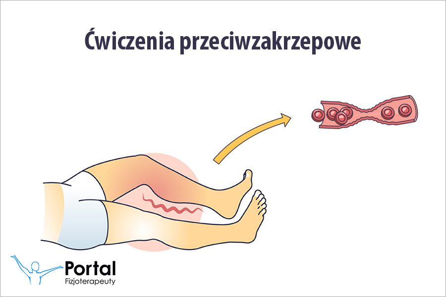 Ćwiczenia przeciwzakrzepowe