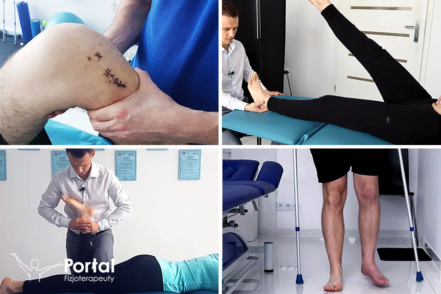 Fizjoterapia ortopedyczna