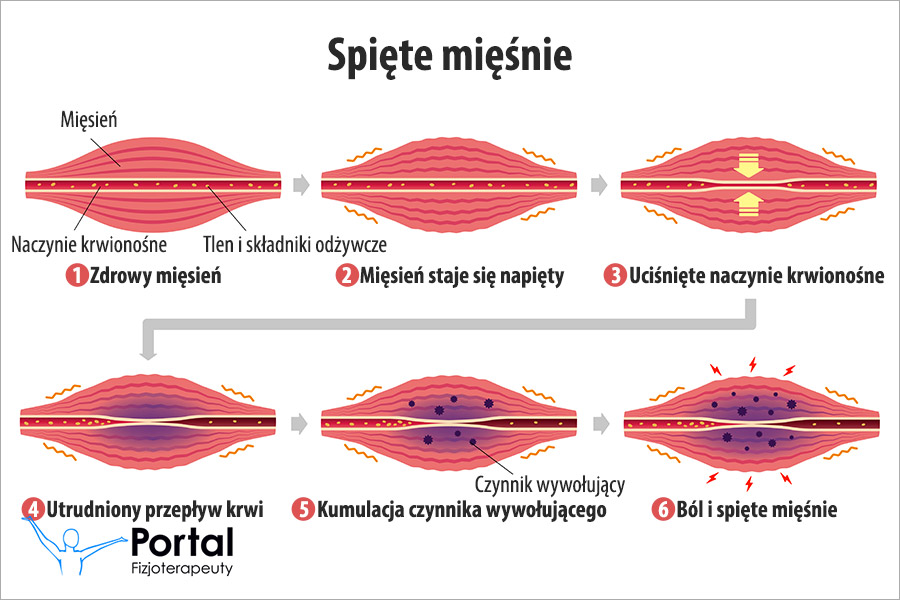 Spięte mięśnie