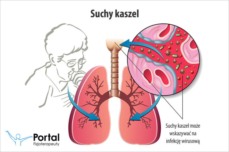 Suchy kaszel