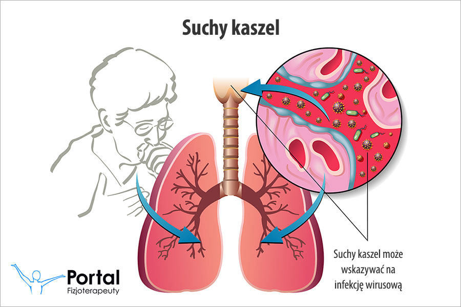 Suchy kaszel