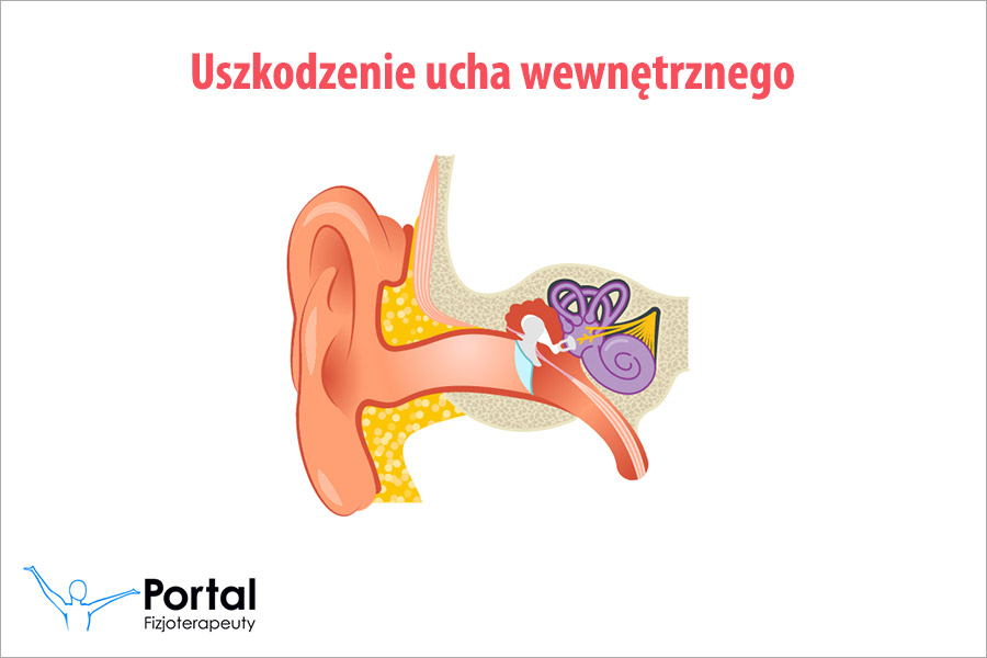 Uszkodzenie ucha wewnętrznego
