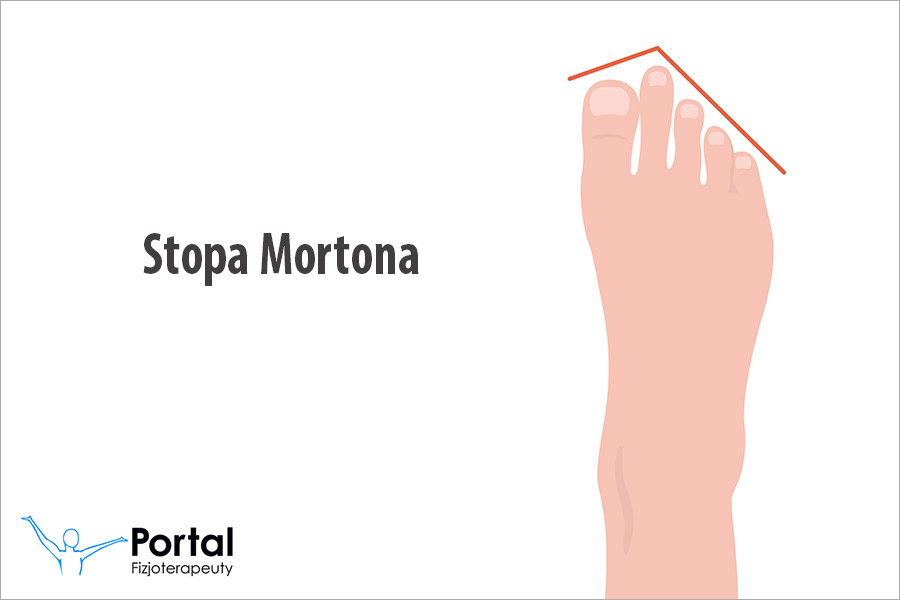 Stopa Mortona