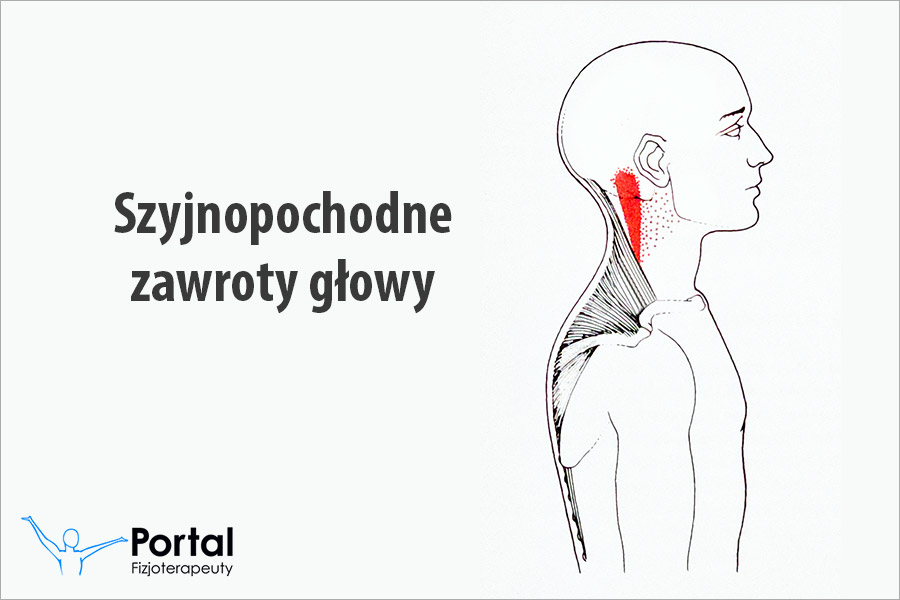 Szyjnopochodne zawroty głowy