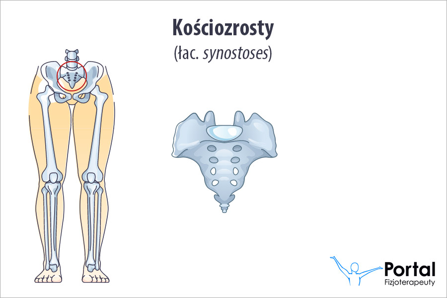 Kościozrosty (łac. synostoses)