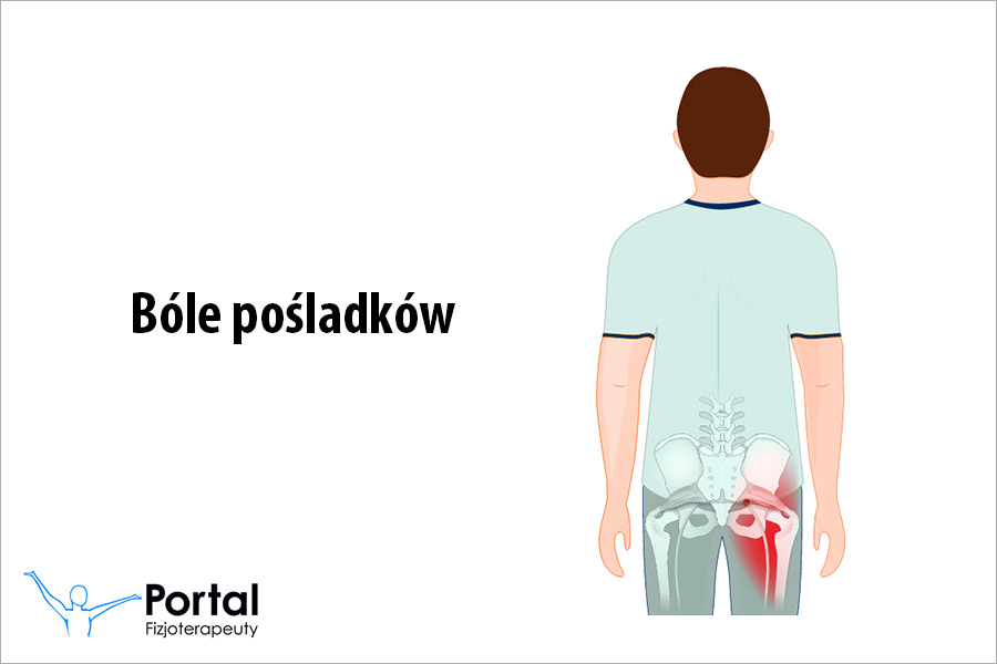 Bóle pośladków