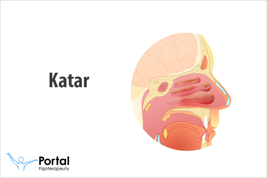 Katar