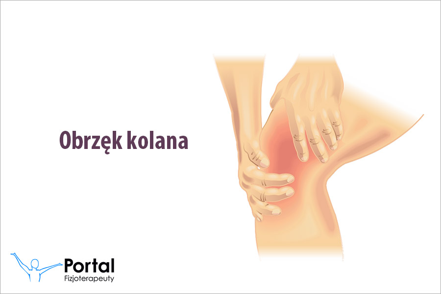 Obrzęk kolana