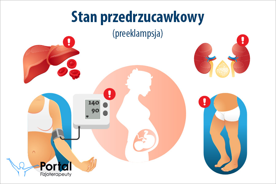 Stan przedrzucawkowy (preeklampsja)