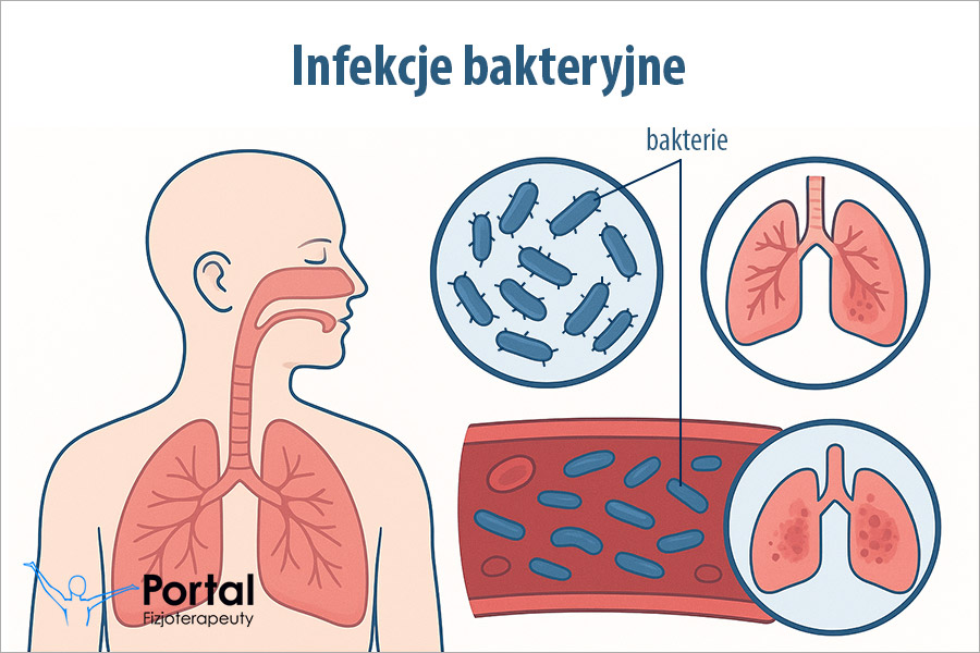 Infekcje bakteryjne
