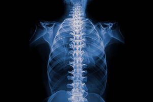 Jedno ćwiczenie, które uratowało 87% pacjentów przed operacją kręgosłupa