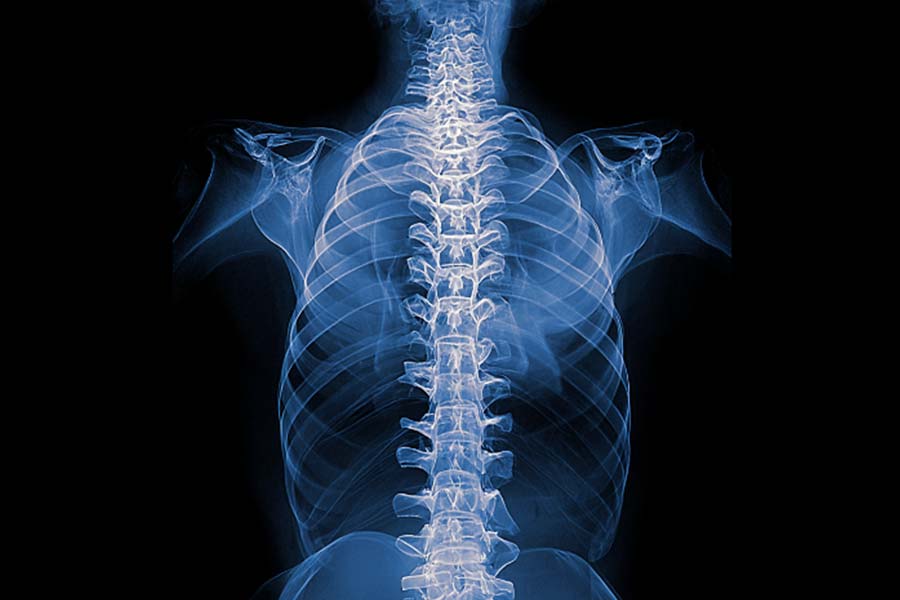 Jedno ćwiczenie, które uratowało 87% pacjentów przed operacją kręgosłupa