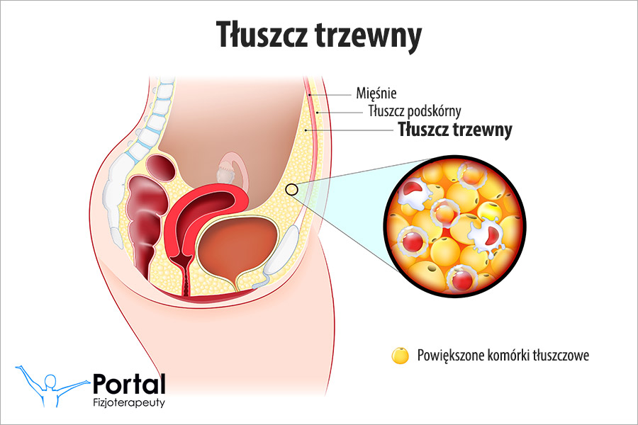 Tłuszcz trzewny