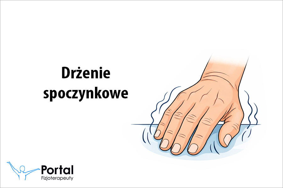 Drżenie spoczynkowe