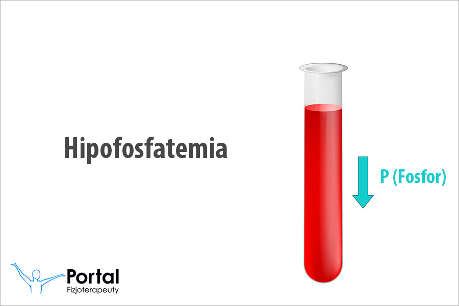 Hipofosfatemia