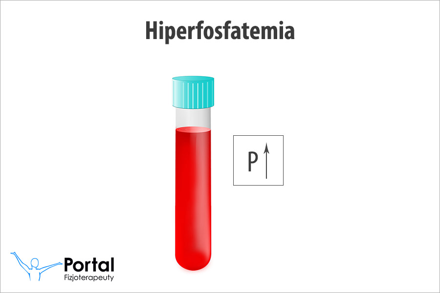 Hiperfosfatemia