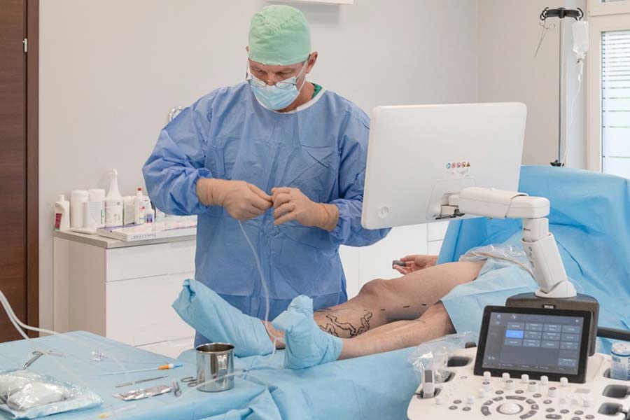 Nowoczesne leczenie żylaków. Czy w 2026 roku można uniknąć bólu i blizn?