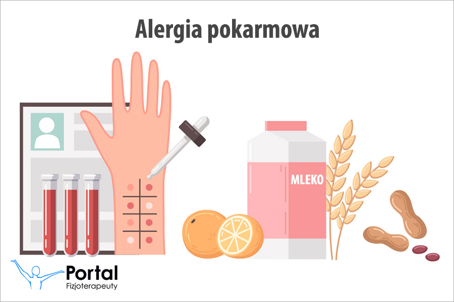 Alergia pokarmowa