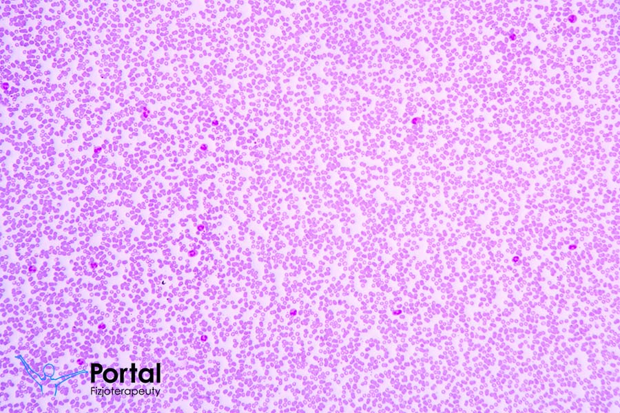 Morfologia krwi z rozmazem