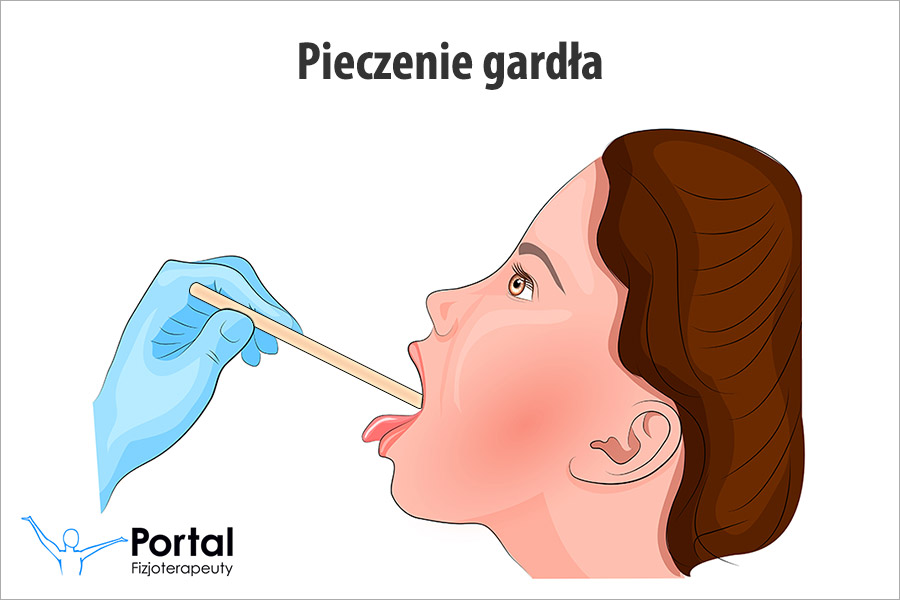Pieczenie gardła