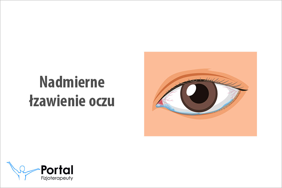 Nadmierne łzawienie oczu