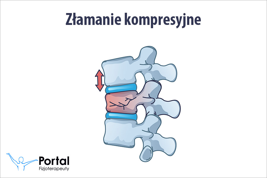 Złamanie kompresyjne