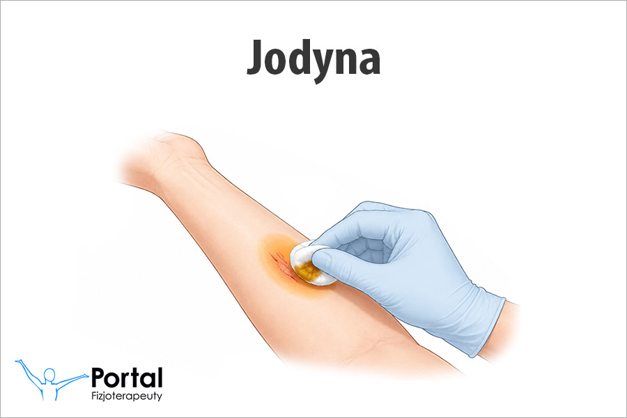 Jodyna