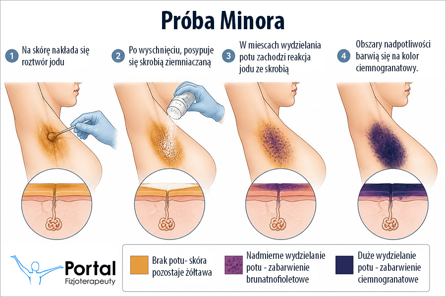 Próba Minora