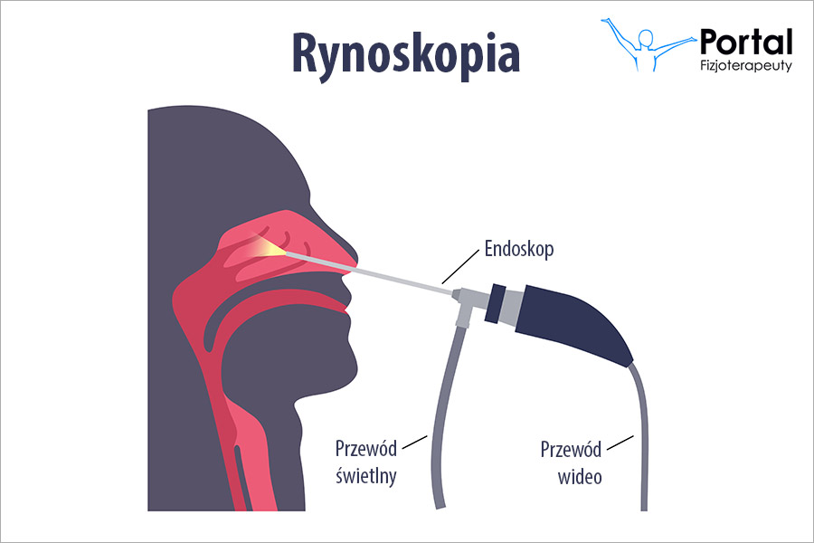 Rynoskopia
