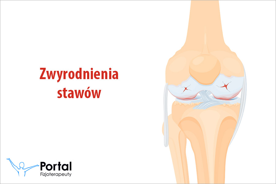 Zwyrodnienia stawów