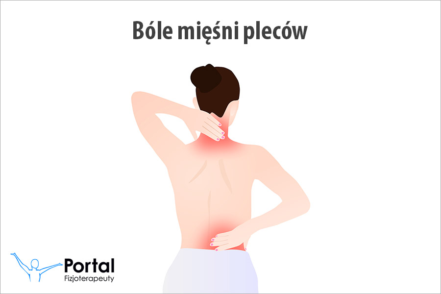 Bóle mięśni pleców