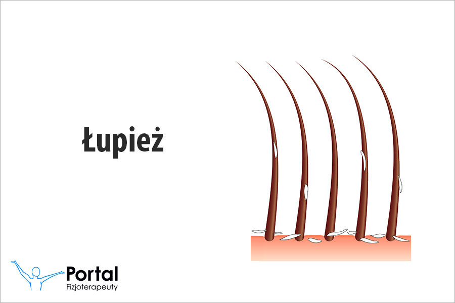 Łupież