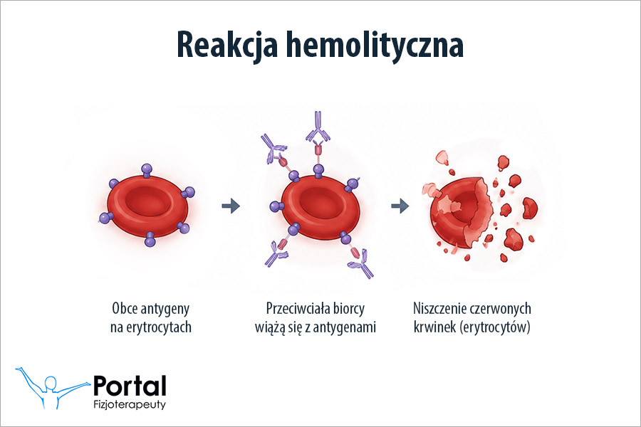 Reakcja hemolityczna