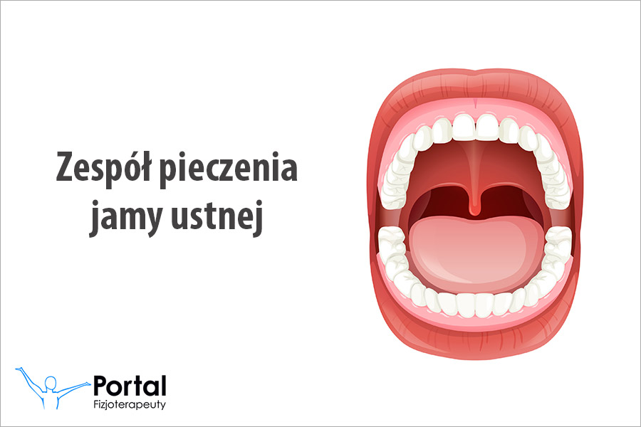 Zespół pieczenia jamy ustnej